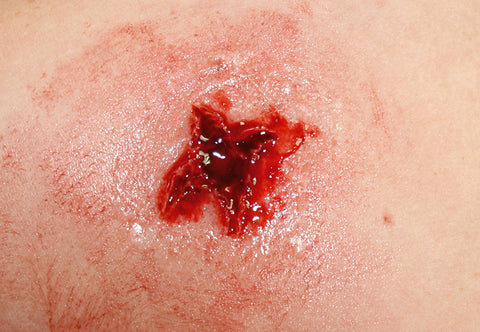 EZ wounds - set profesional de simulare răni