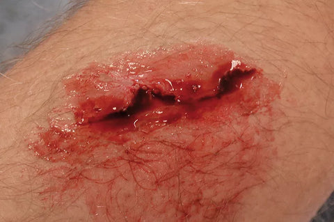 EZ wounds - set profesional de simulare răni