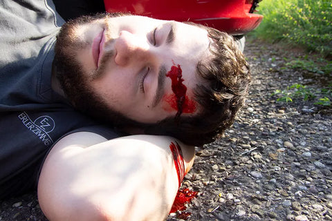 EZ wounds - set de simulare caz pentru pacienți standardizați