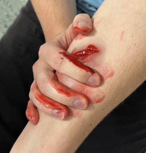 Moulage Rănile - Set Standard