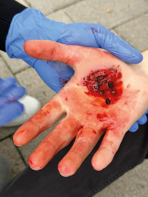 Moulage Rănile - Set Standard