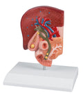 Model calculi biliari