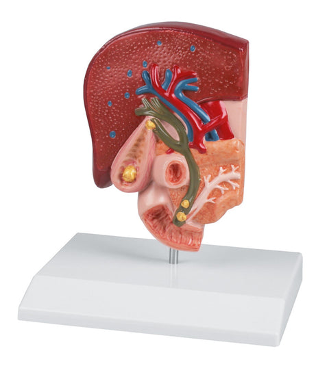 Model calculi biliari