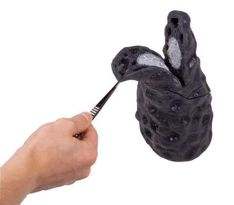 Model cancer pulmonar