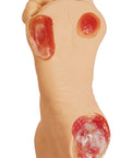 Picior cu ulcer de presiune la vârstnici