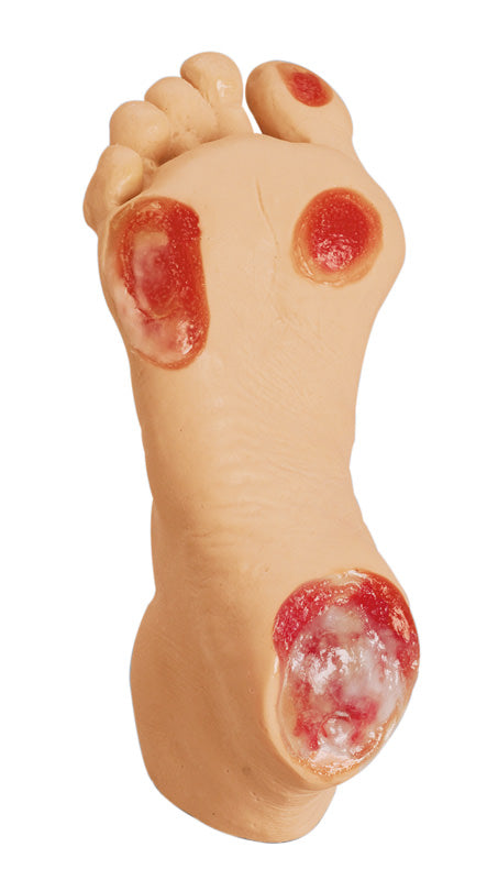 Picior cu ulcer de presiune la vârstnici
